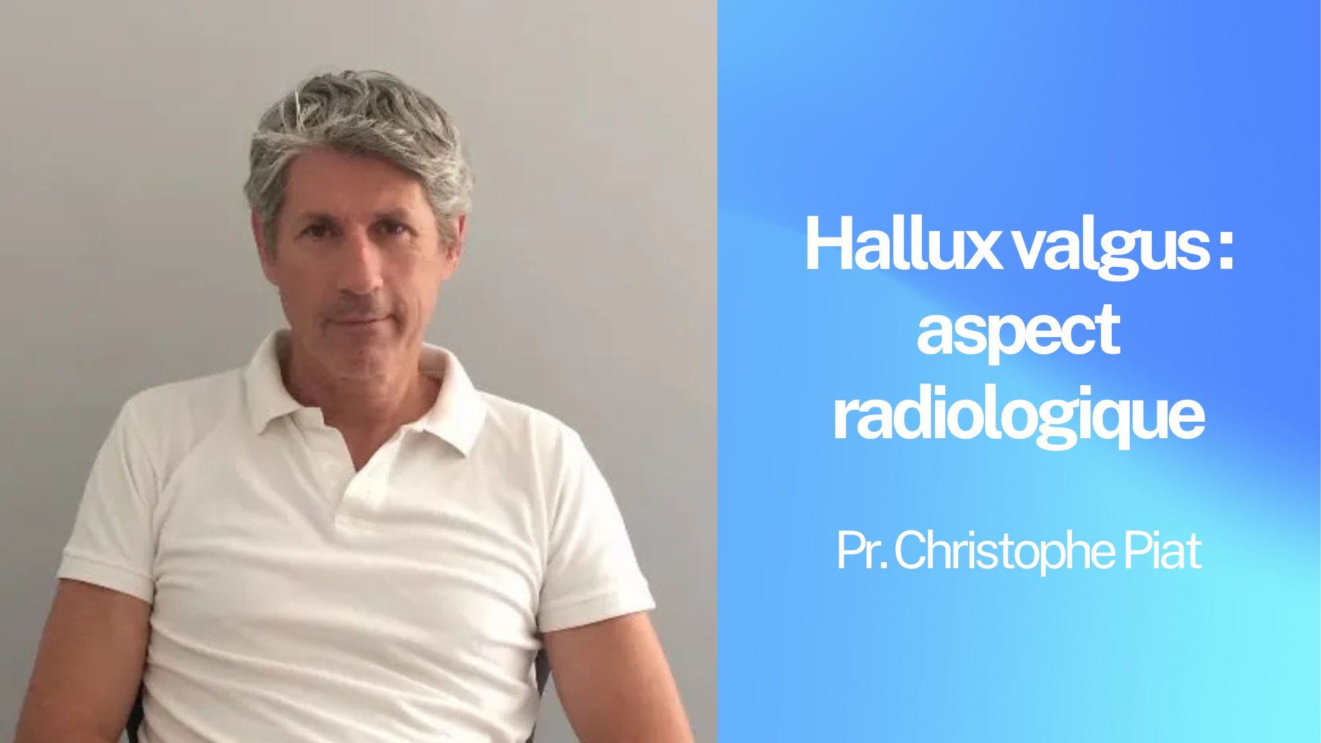 M - Hallux valgus  aspect radiologique.png