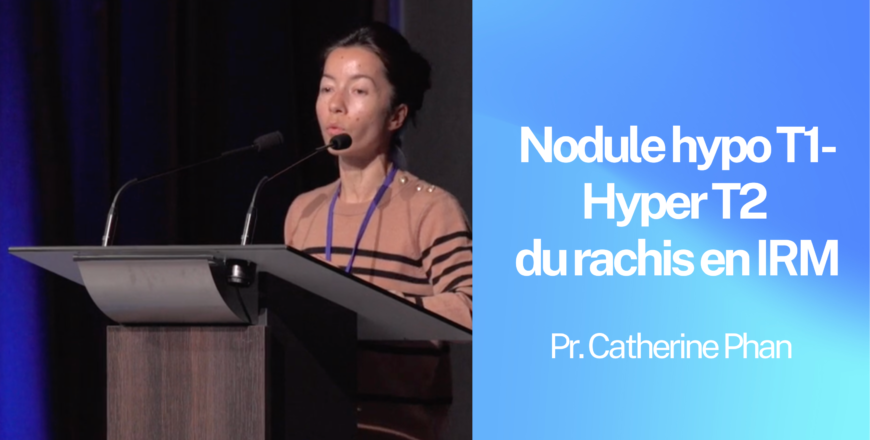 Nodule hypo T1-Hyper T2 du rachis en IRM – ResoneX