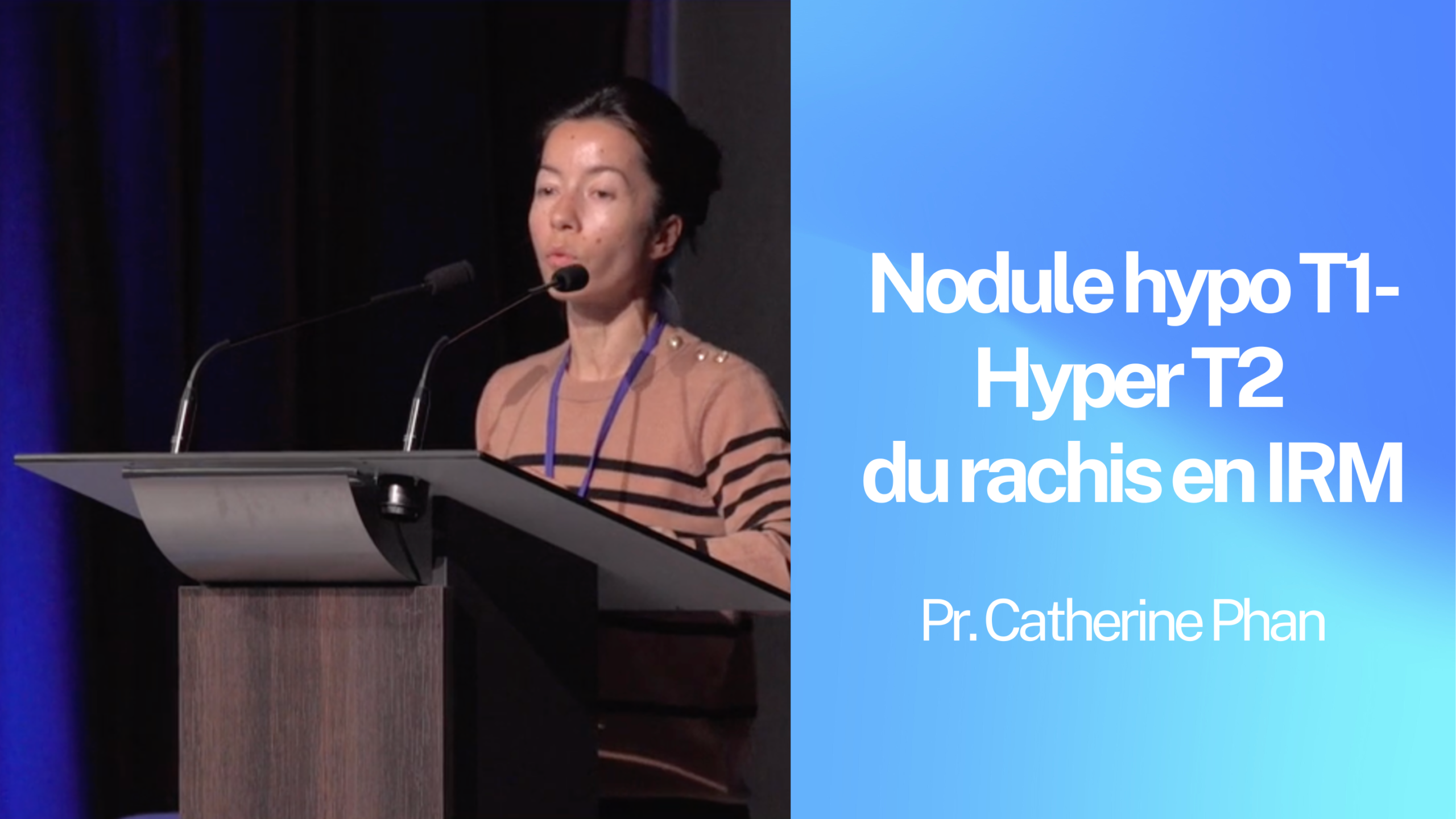 M - Nodule hypo T1-Hyper T2 du rachis en IRM.png